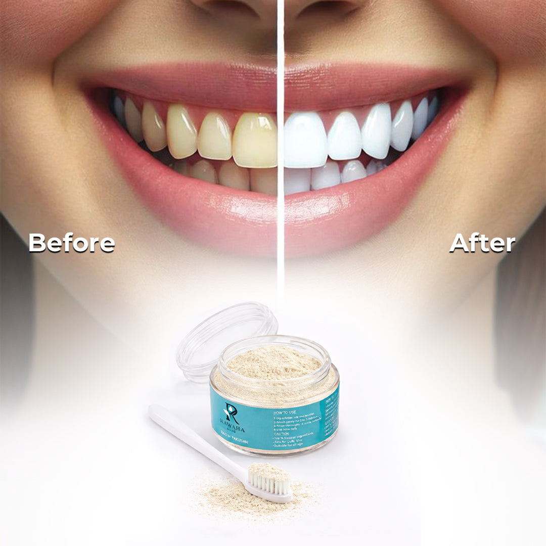 ZIM Teeth Whitening Powder | 100% Natural | Dentist‑Approved, 50g